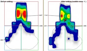 Sattel Neigung / Saddle Tilt