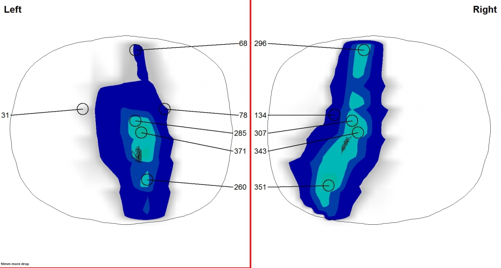 Aeropad_baseline_lab
